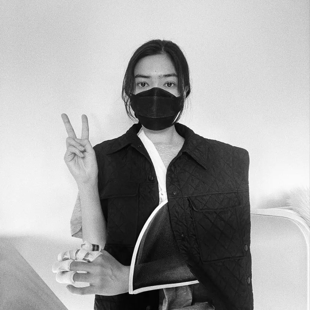 Isyana cedera tangan © Instagram