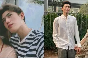 7 Potret kondisi Brisia Jodie dan Julian Jacob usai kecelakaan otopet