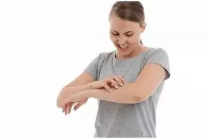 9 Makanan dan minuman ini perlu dihindari saat terkena gatal