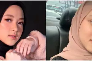Potret Nissa Sabyan pede tunjukkan wajah tanpa makeup dan berjerawat