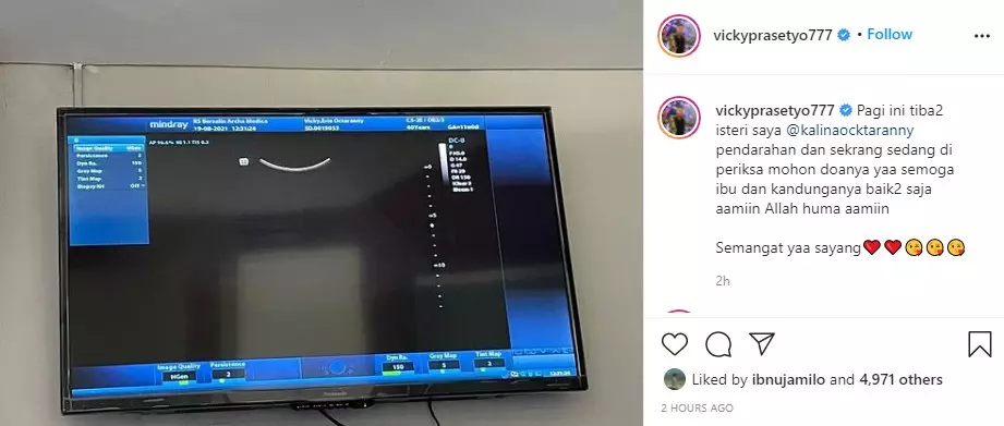 Kalina Ocktaranny menangis alami pendarahan © berbagai sumber Kalina Ocktaranny menangis alami pendarahan © berbagai sumber