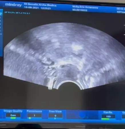 Kalina Ocktaranny menangis alami pendarahan © berbagai sumber Kalina Ocktaranny menangis alami pendarahan © berbagai sumber