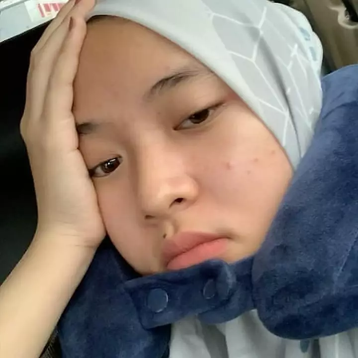 potret nissa sabyan tunjukkan jerawat © instagram potret nissa sabyan tunjukkan jerawat © instagram