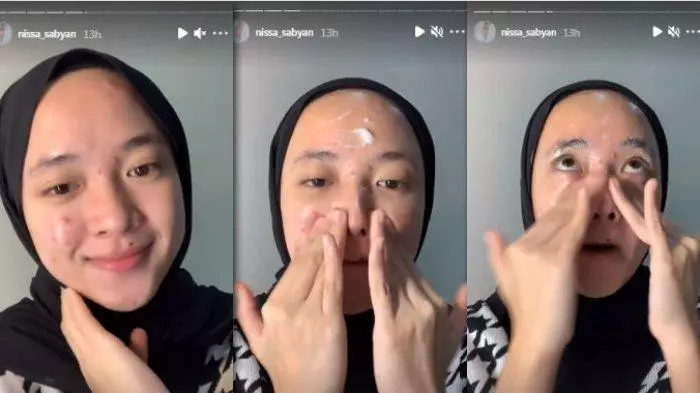 potret nissa sabyan tunjukkan jerawat © instagram potret nissa sabyan tunjukkan jerawat © instagram