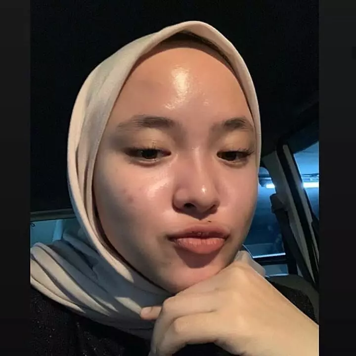 potret nissa sabyan tunjukkan jerawat © instagram potret nissa sabyan tunjukkan jerawat © instagram