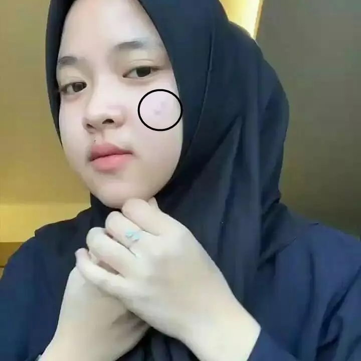 potret nissa sabyan tunjukkan jerawat © instagram potret nissa sabyan tunjukkan jerawat © instagram