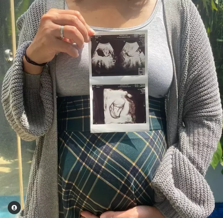 pesona Nola B3 tunjukkan baby bump Instagram/@rafianola pesona Nola B3 tunjukkan baby bump Instagram/@rafianola