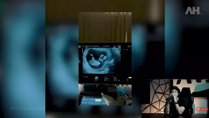 momen aurel hermansyah umumkan kehamilan © YouTube momen aurel hermansyah umumkan kehamilan © YouTube