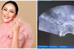 Kalina Oktarani unggah foto makam janin, banjir ucapan duka