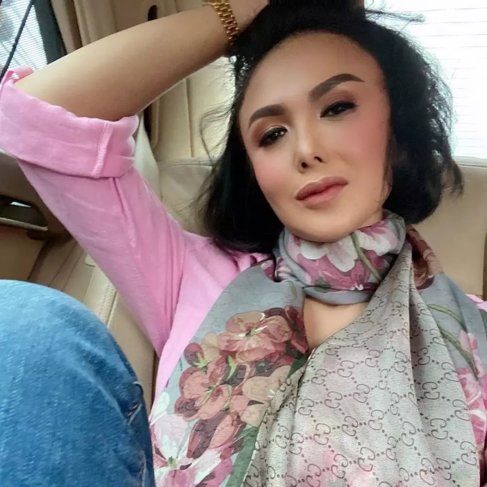 hidung Yuni Shara jadi sorotan Instagram hidung Yuni Shara jadi sorotan Instagram