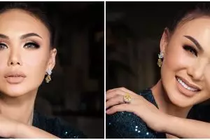 Unggah potret terbaru, hidung Yuni Shara jadi sorotan