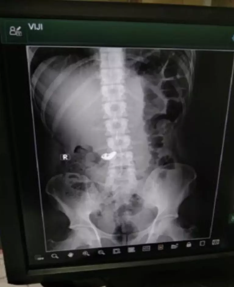 pencuri telan emas © 2021 berbagai sumber