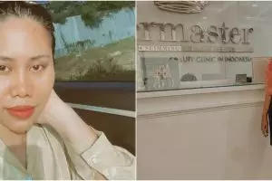 5 Perawatan kecantikan Evi Masamba, seminggu sekali harus ke dokter