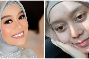 5 Perawatan kecantikan Lesty Kejora, rutin dari tahun 2018