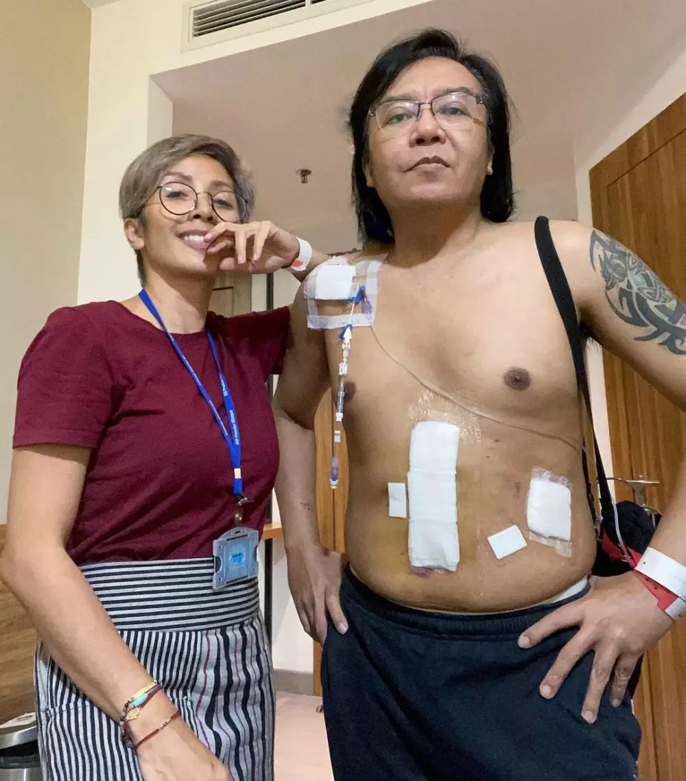 Potret Ari Lasso usai jalani operasi tumor © 2021 brilio.net