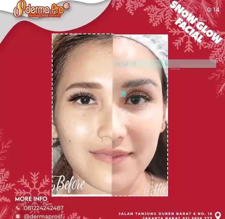 Perawatan Ayu Ting Ting Berbagai sumber 