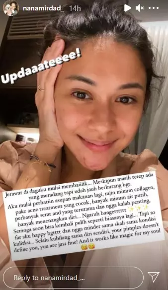 cara Nana Mirdad mengatasinya © Instagram/@nanamirdad_