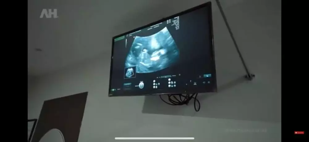 Aurel cek kandungan © 2021 brilio.net Aurel cek kandungan © 2021 brilio.net