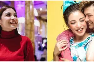 Curhat sedih Chelsea Olivia yang harus hilangkan gigi gingsul