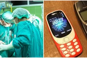 Pria ini tahan sakit selama 4 hari, ternyata ada ponsel di perut