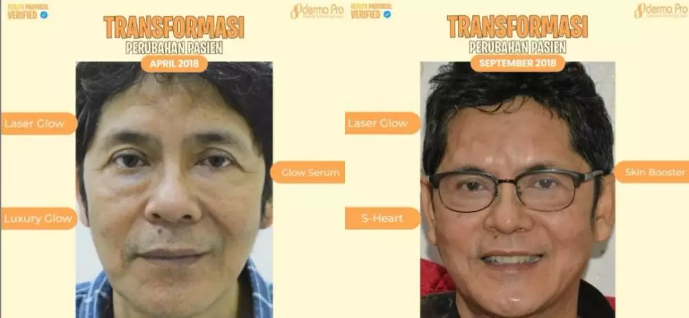 dokter boyke perawatan wajah Instagram/@klinikdermaprojakarta