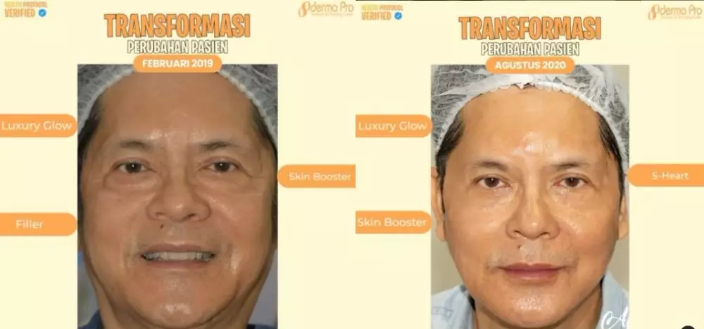 dokter boyke perawatan wajah Instagram/@klinikdermaprojakarta