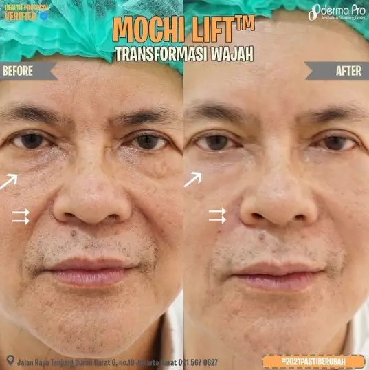 dokter boyke perawatan wajah Instagram/@klinikdermaprojakarta