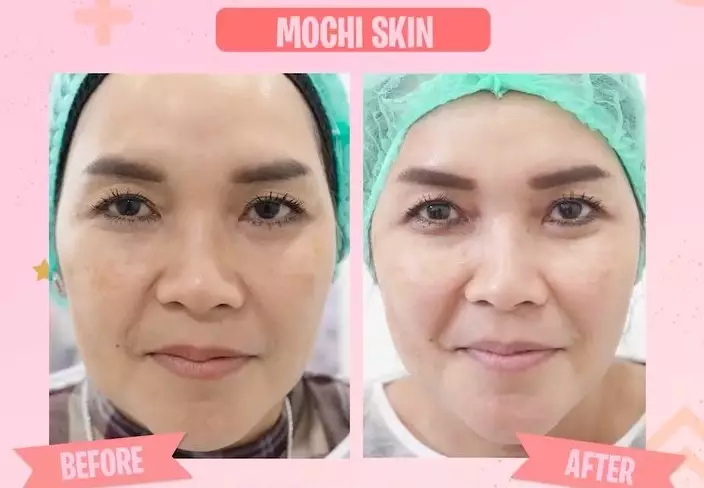 momen orang tua ayu ting ting perawatan © instagram momen orang tua ayu ting ting perawatan © instagram