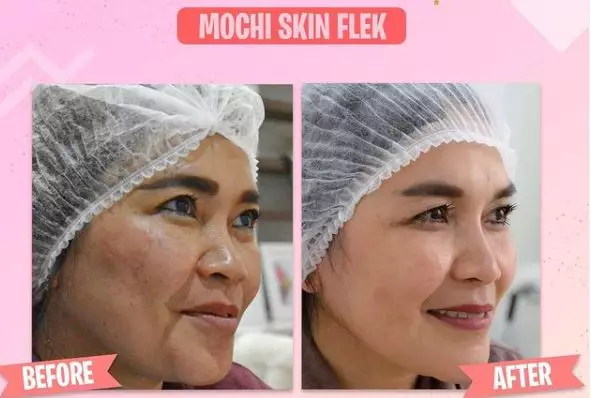 momen orang tua ayu ting ting perawatan © instagram momen orang tua ayu ting ting perawatan © instagram