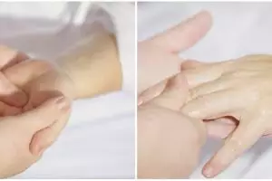 Hobi merenggangkan sendi & otot sampai bunyi 'krek'? Waspadai hal ini