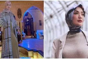 Curhatan Imel Putri usai jalani kemoterapi, alami perubahan penampilan