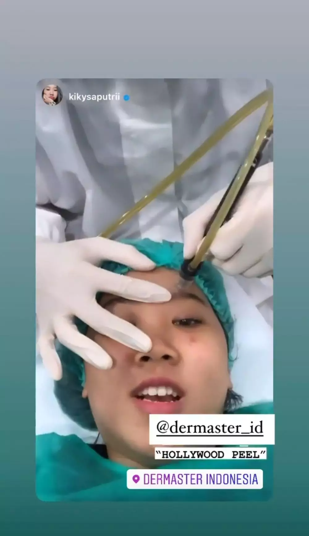 Perawatan Kiky © 2021 brilio.net Perawatan Kiky © 2021 brilio.net