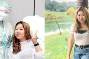 Whitening hingga rapikan gigi, ini 5 perawatan kecantikan Kiky Saputri