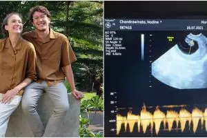 Dengarkan detak jantung janin, respons Dimas Anggara bikin ketawa