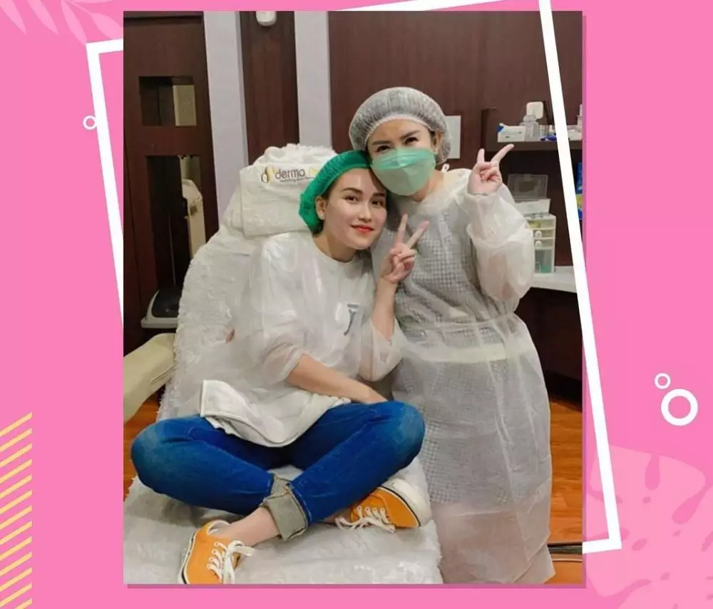 ayu ting ting sebelum dan sesudah perawatan © instagram