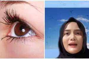 Pernah lihat bayangan hitam saat menatap langit? ini penyebabnya