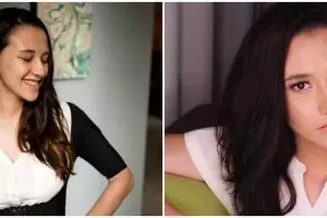 Dicibir wajah banyak komedo, ini jawaban menohok Dahlia Poland