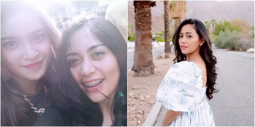 beda penampilan Rachel Vennya dulu dan kini Berbagai sumber  beda penampilan Rachel Vennya dulu dan kini Berbagai sumber