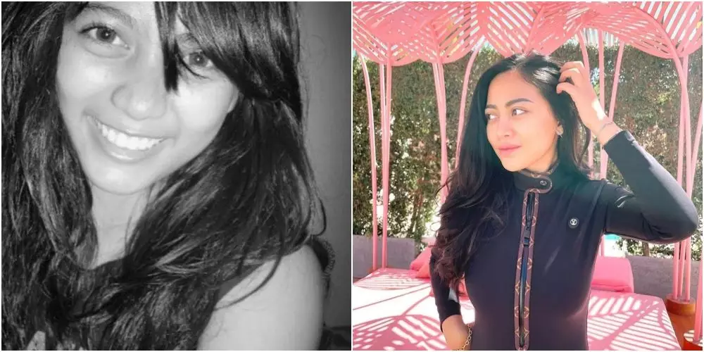 beda penampilan Rachel Vennya dulu dan kini Berbagai sumber  beda penampilan Rachel Vennya dulu dan kini Berbagai sumber