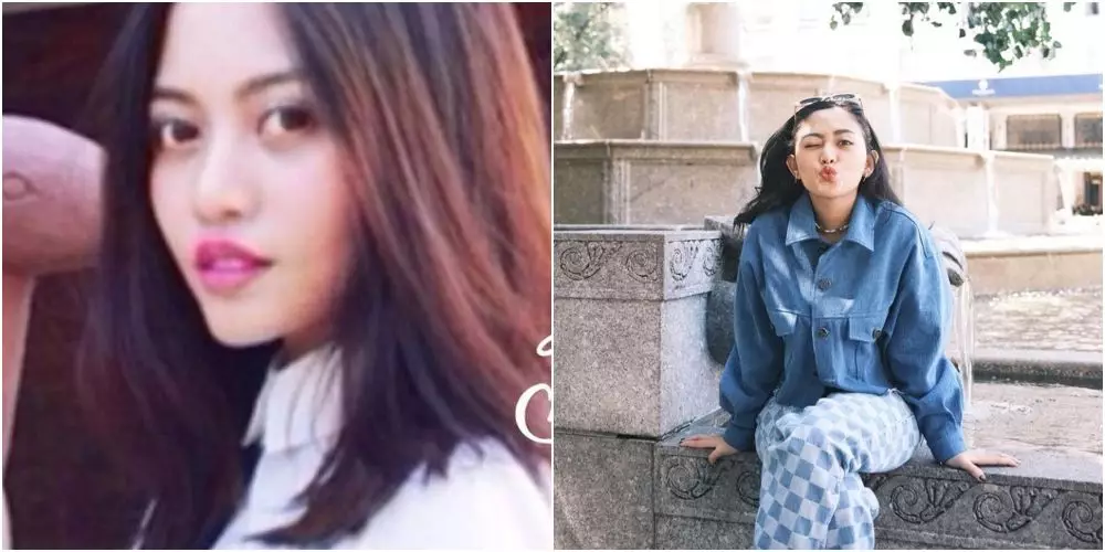 beda penampilan Rachel Vennya dulu dan kini Berbagai sumber  beda penampilan Rachel Vennya dulu dan kini Berbagai sumber