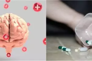 Mengenal penyakit aneurisma otak, gejala dan cara penyembuhannya