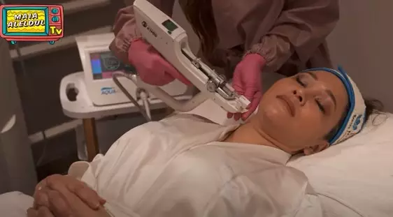 Maia alami rosacea © YouTube