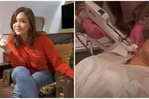 Maia Estianty alami penyakit kulit wajah, akui sulit disembuhkan