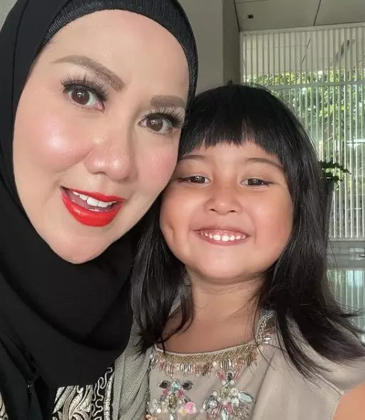 paras Venna Melinda disebut mirip anak angkatnya © Instagram/@vennamelindareal