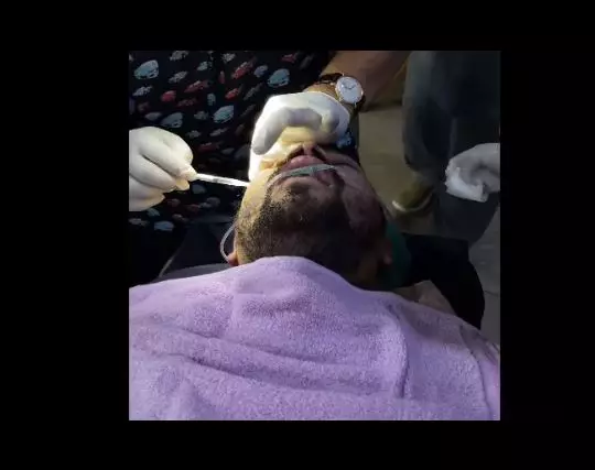 momen raffi ahmad perawatan wajah © berbagai sumber