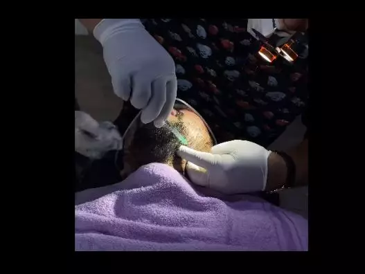 momen raffi ahmad perawatan wajah © berbagai sumber