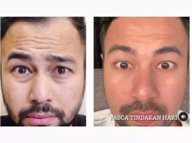 momen raffi ahmad perawatan wajah © berbagai sumber