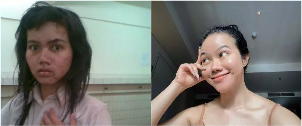 perubahan penyanyi saat sma dan kini © berbagai sumber