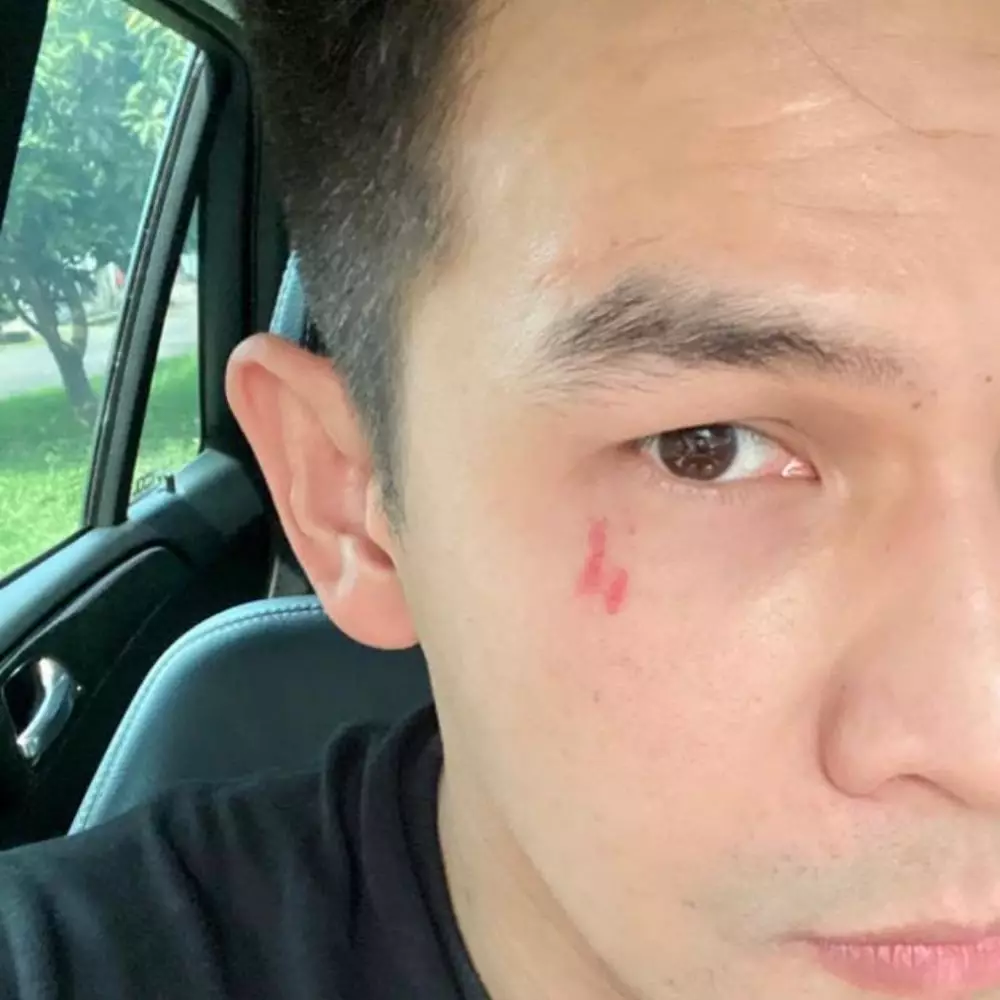 Benny Simanjuntak unggah potret Jonathan Frizzy dengan luka cakar Instagram Benny Simanjuntak unggah potret Jonathan Frizzy dengan luka cakar Instagram