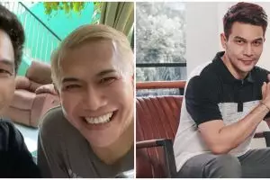 Unggahan foto Jonathan Frizzy dengan luka cakar di wajah tuai simpati